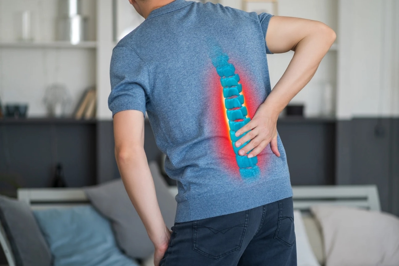 spinal cord stimulation